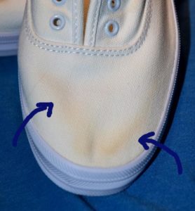 yellow stains on sneakers