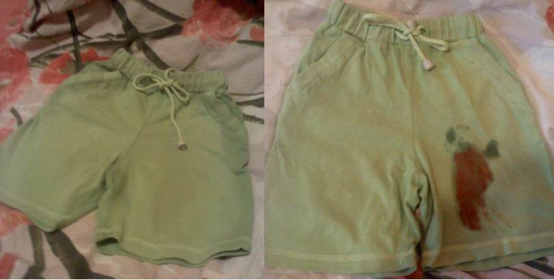 stain on shorts