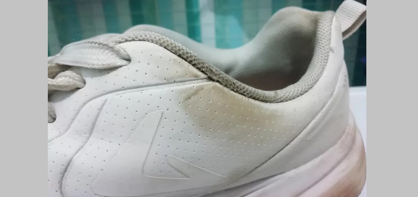 the sneakers turned yellow