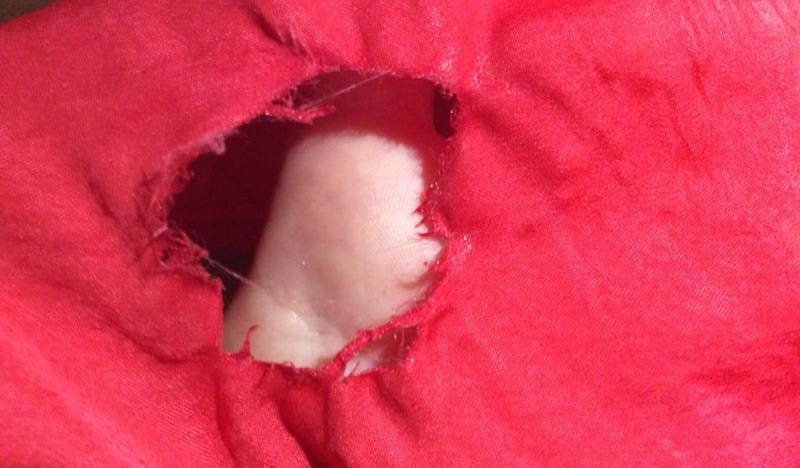 There's a hole in my clothes because of the machine