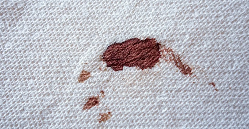 dried blood on the fabric
